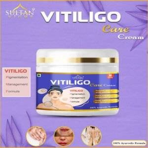 Vitiligo Cream : An ancient ayurvedic cream | Revitalize your skin | Prevent Patches and Irritation | Bring back the original color of your skin